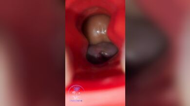 Missionary Spred Frot Straight Edge Intimaly Red Tunnel Cock Block Dangling Close Up Twink Shorties