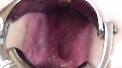 Elmer mega anal gape