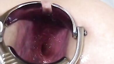 Elmer mega anal gape