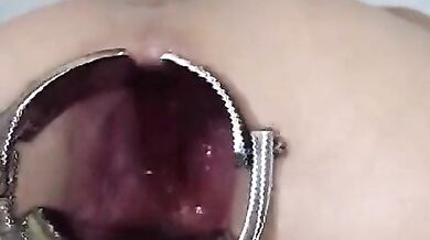 Elmer mega anal gape