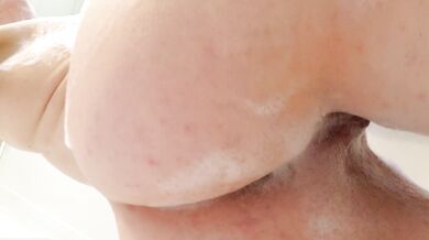 "I Did a Loud Fart!"