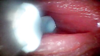 Inside Penis Sperm Journey Endoscopic Footage - Ladytwitti Amateur Cumshot Education