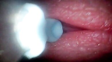 Inside Penis Sperm Journey Endoscopic Footage - Ladytwitti Amateur Cumshot Education
