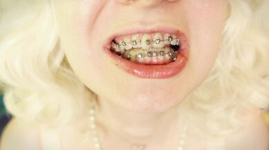 BRACES fetish ASMR video with great CHEWING SWALLOWING SOUNDS