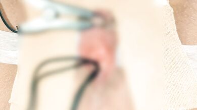 An electric current was applied to the clitoris and a needle was inserted. ???????? The main story is 49